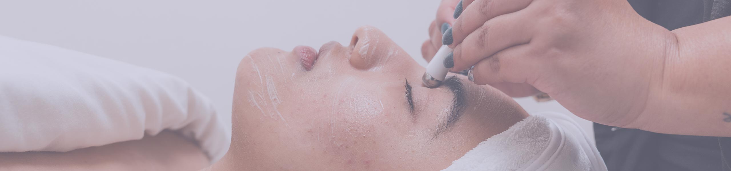 facials-surrey-skin-care-treatment