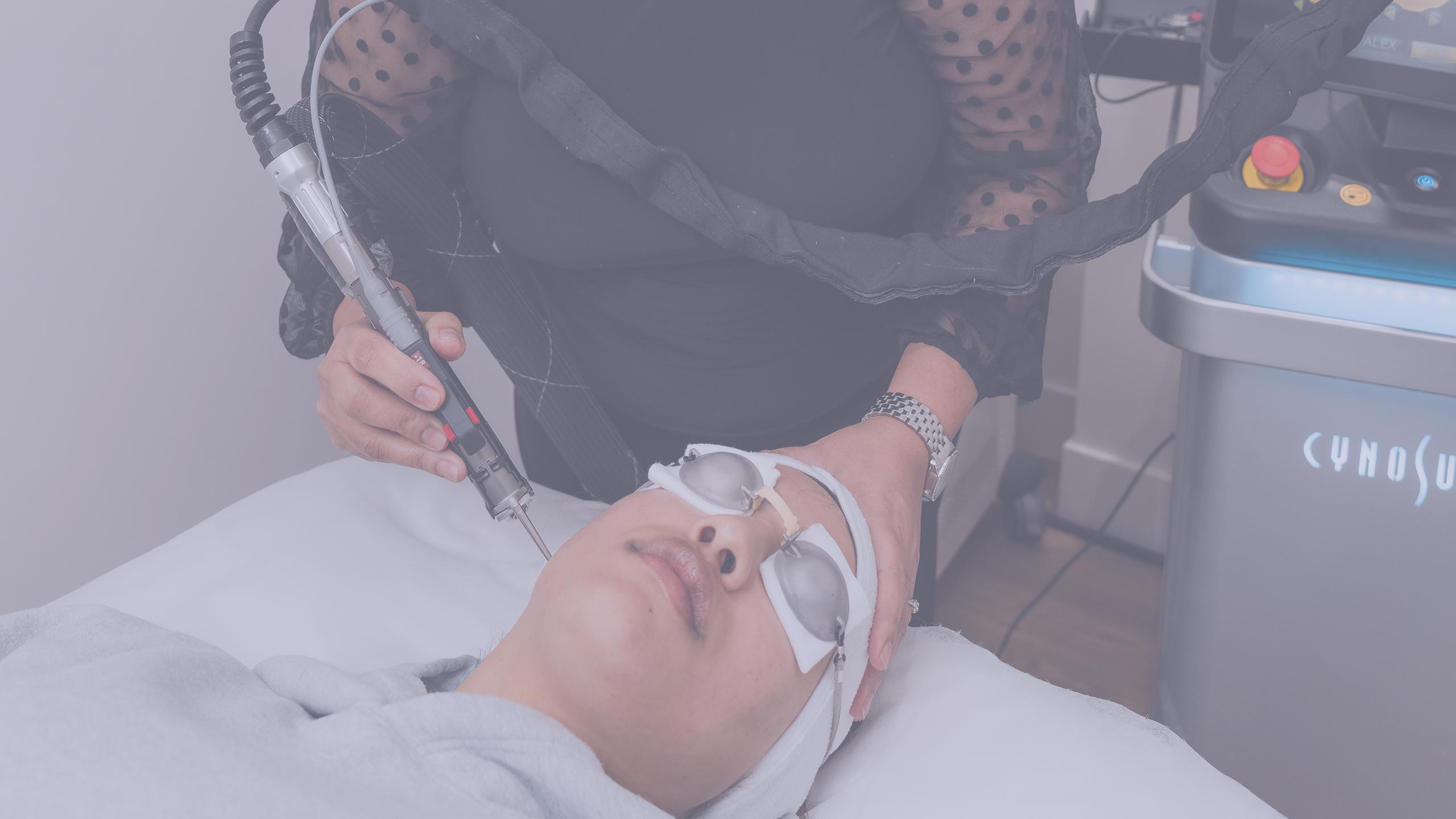laser-removal-surrey